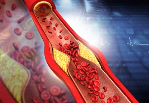Podwyższenie poziomu cholesterolu HDL - objawy i wskazówki