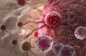 Dosterlimab - remisja raka jelita grubego u wszystkich badanych pacjentów