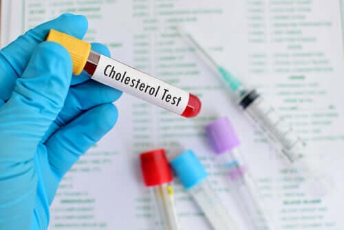 Cholesterol HDL i LDL: wszystko, co musisz wiedzieć