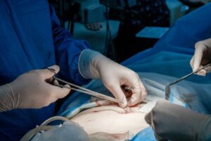 Przeszczep skóry: kiedy się go wykonuje?