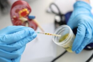 Urobilinogen w moczu: przyczyny i prawidłowe wartości
