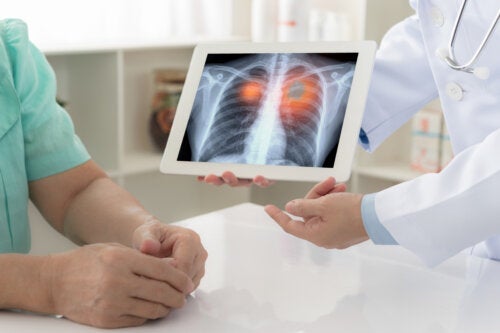 Plama na płucu: główne przyczyny i leczenie