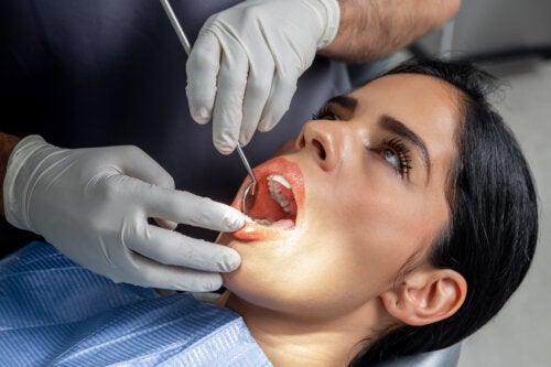 Wytrawianie kwasem: co to za procedura dentystyczna?