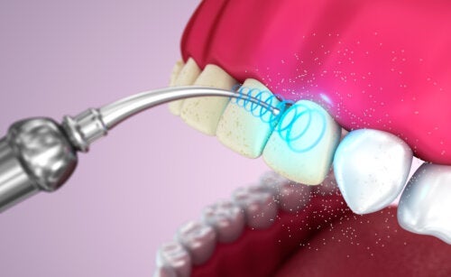 Ultradźwiękowe czyszczenie zębów: zalety i wady