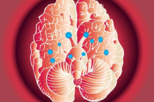 Nerwy czaszkowe - poznaj dwanaście rodzajów i ich funkcje