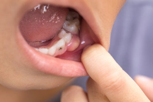 Objawy infekcji zębów, która rozprzestrzenia się na organizm