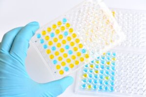 Test krwi ELISA: do czego służy i jak się go wykonuje