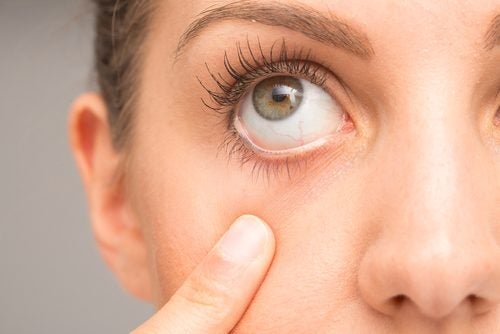 Nerwowe tiki oczu - kilka wskazówek dotyczących leczenia