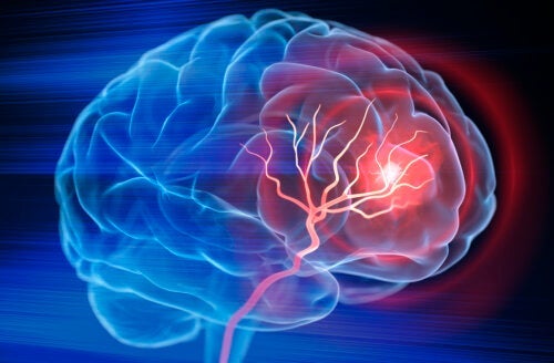 Światowy Dzień Udaru Mózgu: kilka minut może uratować życie