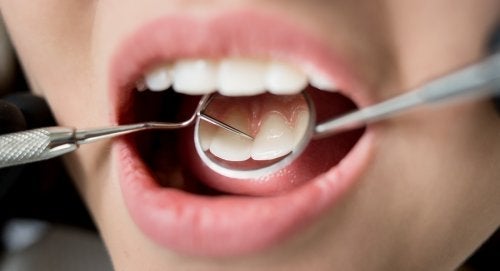 Zdrowie jamy ustnej - konsekwencje zaniedbań