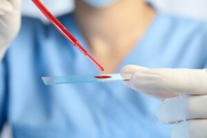 Przewlekła białaczka eozynofilowa: objawy, diagnoza i leczenie
