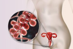 Żółta wydzielina z pochwy: 5 przyczyn i sposoby leczenia