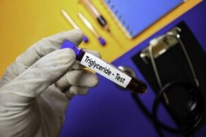 Poziom trójglicerydów: co powinieneś wiedzieć?