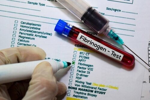 Fibrynogen - czynnik mający znaczenie w badaniu krwi