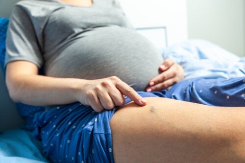 Zapalenie żył w ciąży: objawy i leczenie