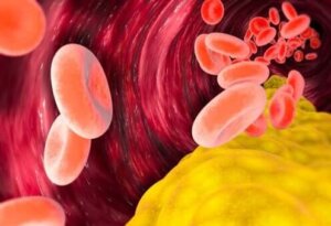 Czy cholesterol VLDL jest szkodliwy?