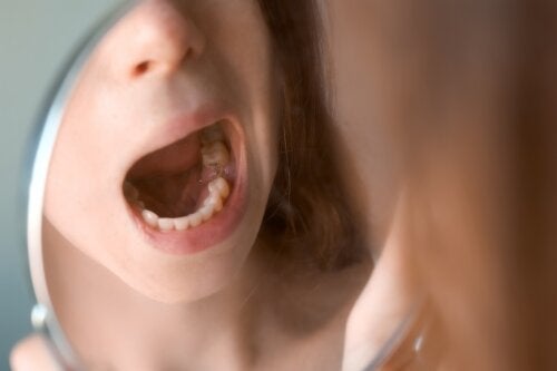 Brodawczak w jamie ustnej: objawy i zapobieganie