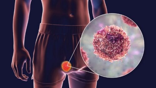 Potworniak - rodzaje, objawy i leczenie